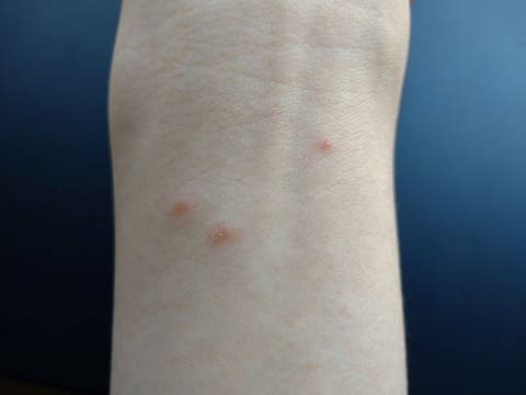 手首 手首の写真