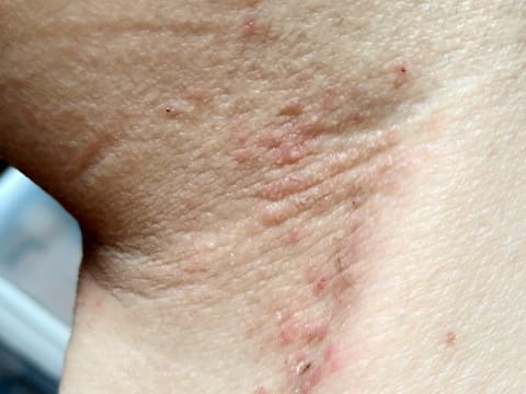 膝裏 膝裏の写真