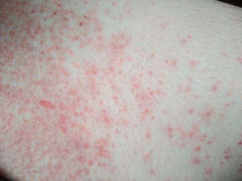 太もも 太ももの写真